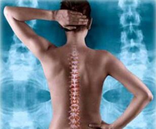 илюстрация на гръбначния стълб