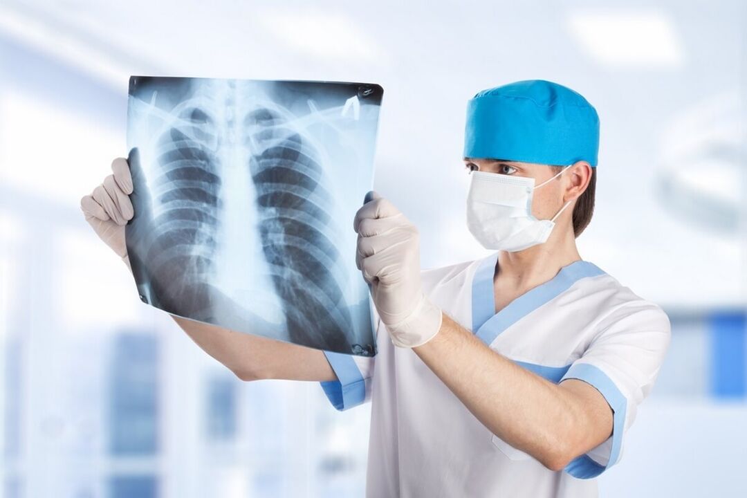 Рентгенова снимка на гръдния кош с остеохондроза