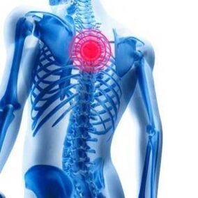 болки в гърба при гръдна остеохондроза
