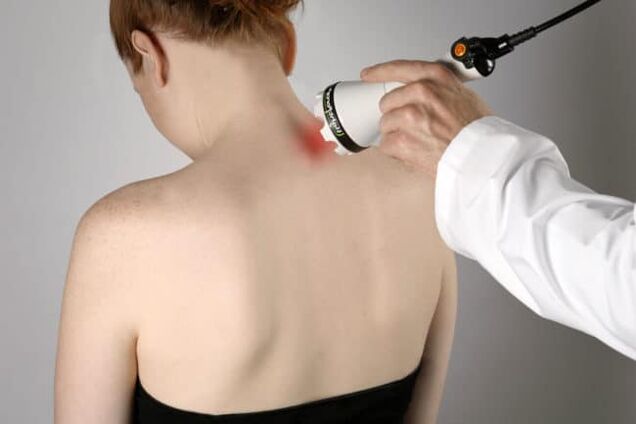 Лазерната терапия се използва за борба с болки в гърба в областта на лопатката. 