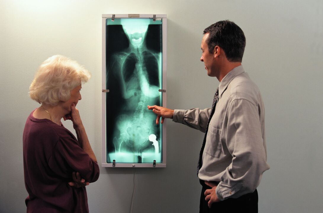 рентгенова диагностика на болка в тазобедрената става